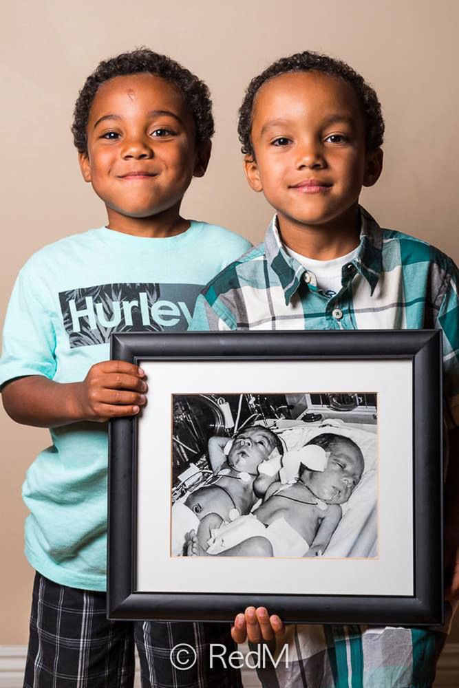 1 Noah and Nathan, born at 32 weeks